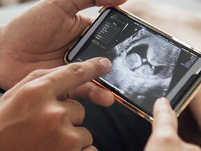 Questions to ask at your 12-week Scan Questions to ask at your 12-week Scan