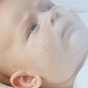 Baby allergies – Ask the expert Baby allergies – Ask the expert
