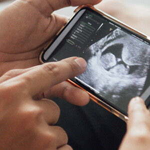 Questions to ask at your 12-week Scan Questions to ask at your 12-week Scan